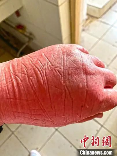 图片由陆军军医大学士官学校附属医院提供