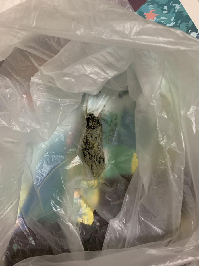 ▲程先生已将喝出的异物保存留证，目前该异物已经缩成一团。 新京报记者 李睿阳 摄