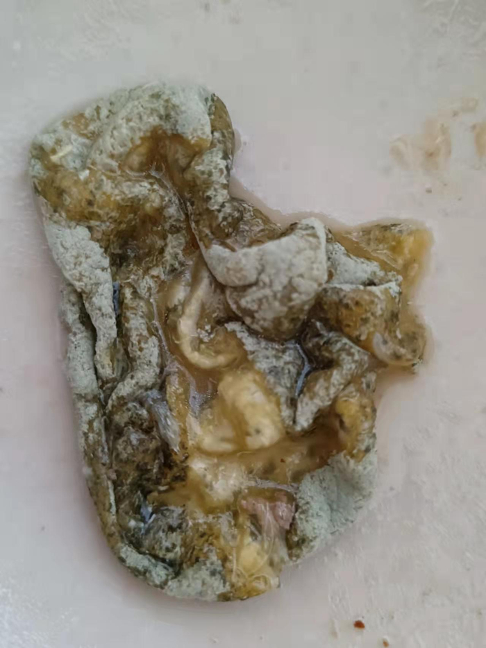 ▲程先生喝出的异物。受访者供图