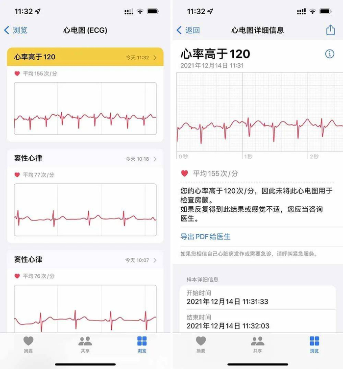 高于 120 心率的心电图无法用于检查房颤