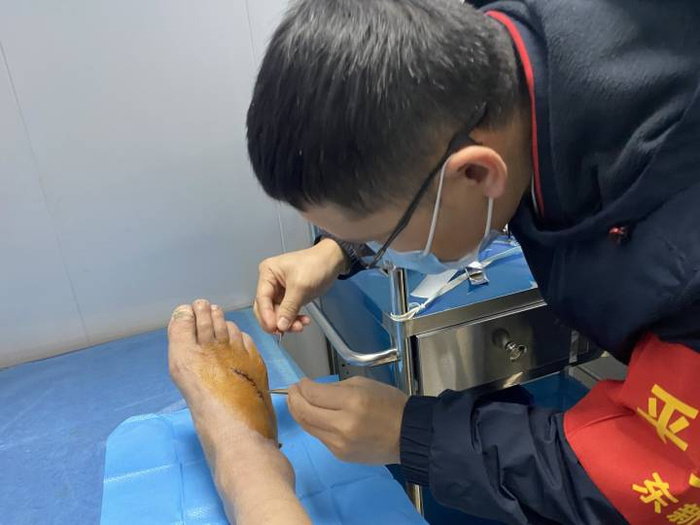 曹延广医生为居民拆线。