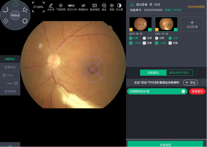 眼科多病种辅助诊断AI界面。资料图片