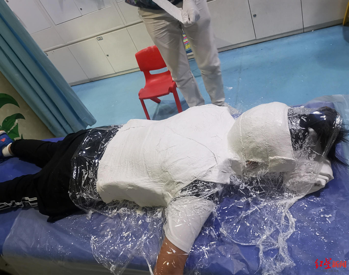  ▲在医院接受治疗的涵涵