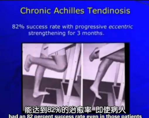 ▲很有效的治疗慢性跟腱炎的方法：“踮脚尖”