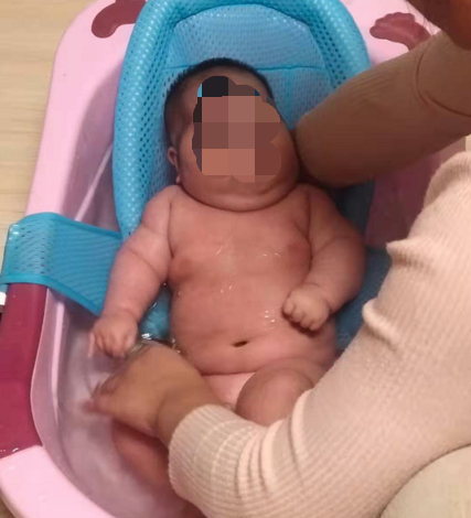 　　“青岛大头娃娃”事件资料图。图片来源：受访家长供图