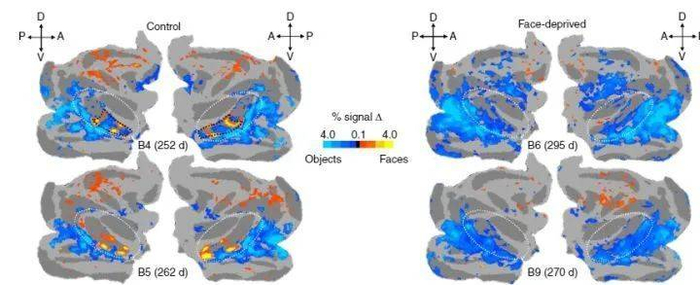 左边为正常猴子，右边为面部剥夺猴子，可以看到在200天左右，橙黄色的面部识别区没有形成 | 图源：Arcaro M J, et al. 2017.
