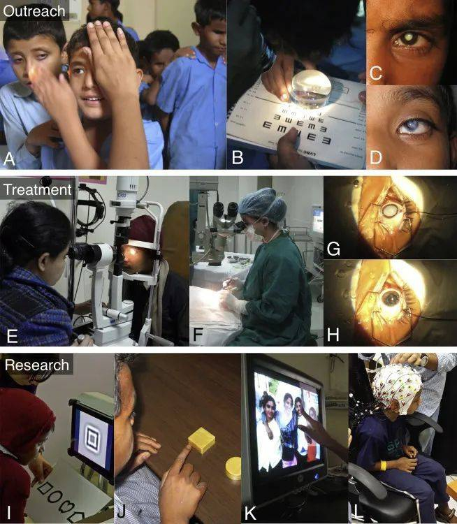 该项目的目标包括帮助更多视力障碍儿童（A-D），提供治疗帮助（E-H）以及开展相关科学研究（I-L）| 图源：Sinha P. 2016.