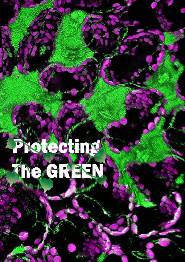 图说：植物免疫系统协同放大活性氧产生来抵抗病原菌的入侵。其中绿色表示叶片内部活性氧的产生情况，紫色代表植物的叶绿体 来源/中科院分子植物科学卓越创新中心