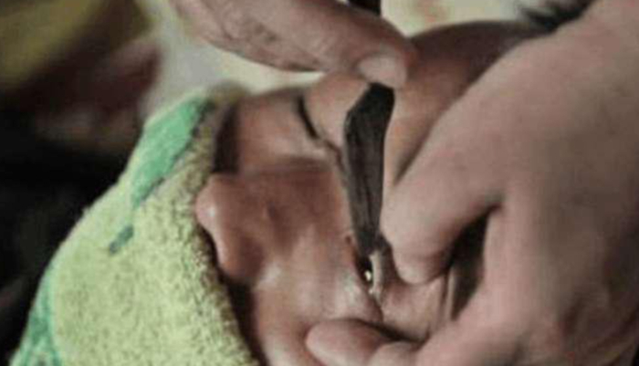 “躺在刀下你能做的只有祈祷师傅的手千万别抖”