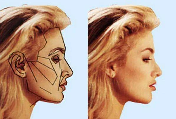 当代美女|beautyanalysis