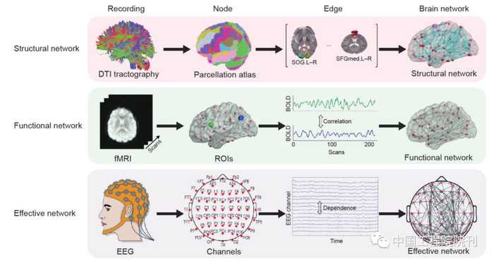 图1 宏观尺度下大脑结构连接、功能连接和因果连接构建流程。SOG：上枕部；SFGmed：额上回，内侧部分；L和R分别代表左和右