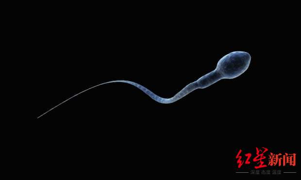▲精子 图据卫报