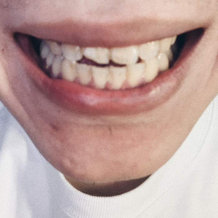 阿尔法花泽类/供图