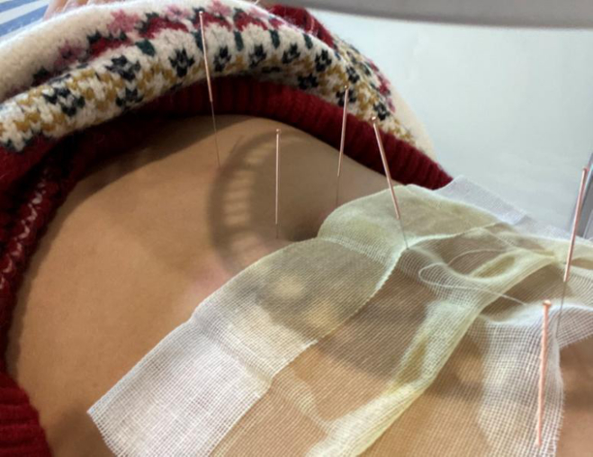 图 | 我在医院扎针治疗