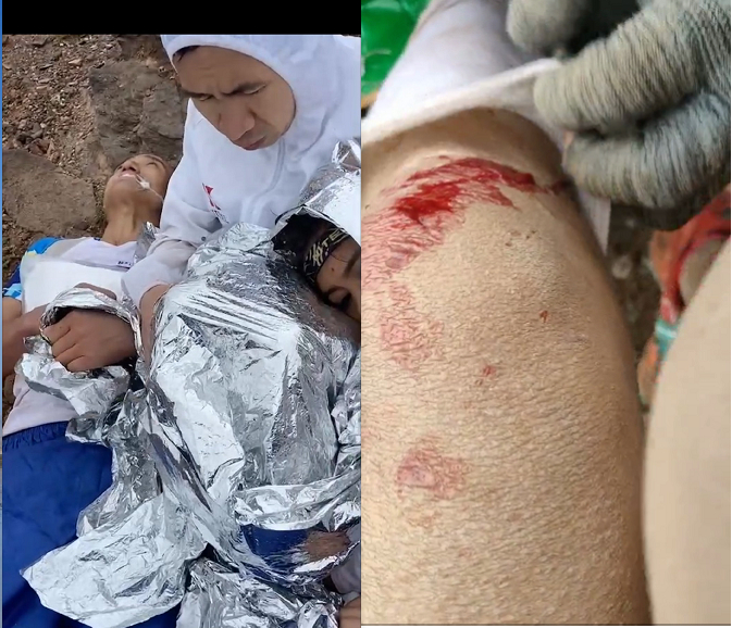 参赛选手遭遇意外