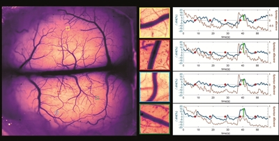 清醒小鼠在气流刺激胡须下的全脑结构—功能成像。（清华大学成像与智能技术实验室供图）