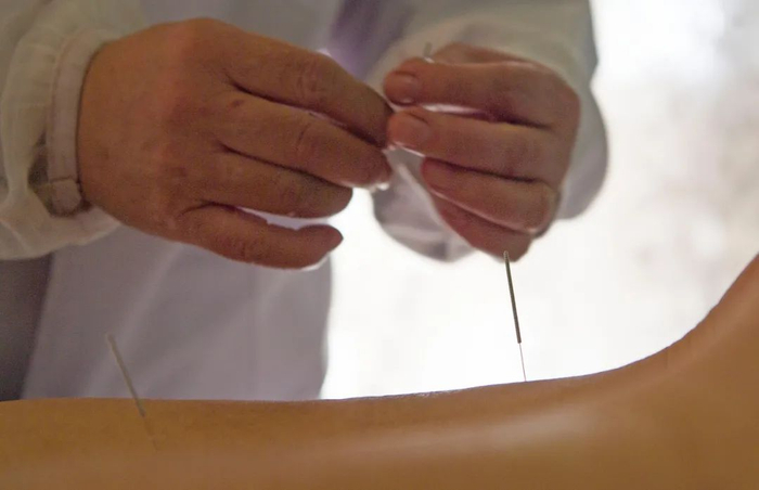 ▲南非约翰内斯堡中国中医诊疗院内，孙庆涪对病人进行针灸治疗。新华社记者 陈诚 摄