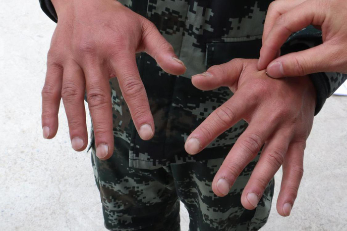 （高原官兵氧化的指甲）