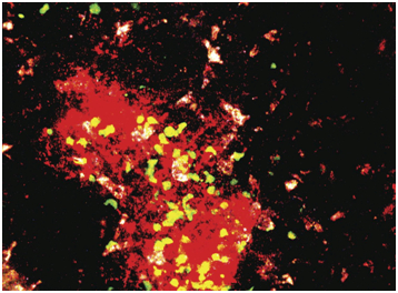 生发中心区域示意图