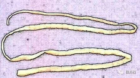 美颜过的阔节裂头绦虫，作者已尽力…… via：needjoy.net