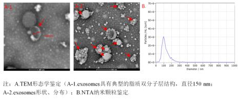  图8 外泌体（exosomes）提取与鉴定
