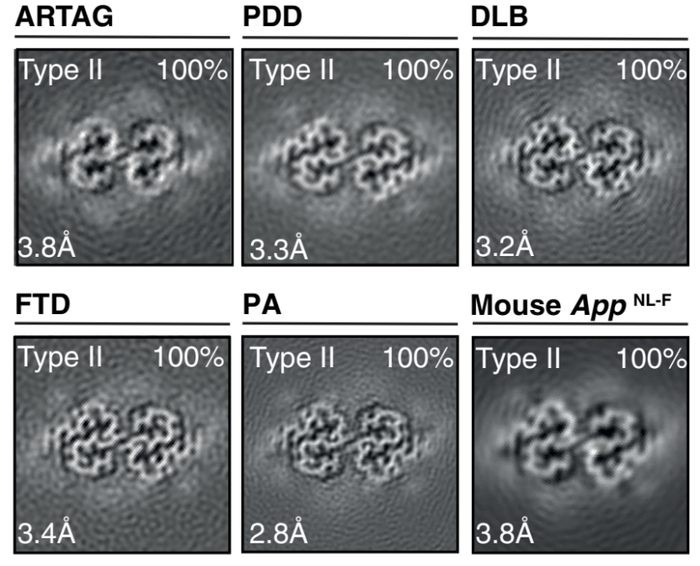 其他疾病患者及APP NL-F小鼠脑内II型细丝的冷冻电镜结构