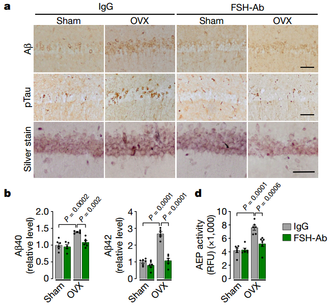 FSH抗体治疗后病理蛋白减少，认知下降有所好转