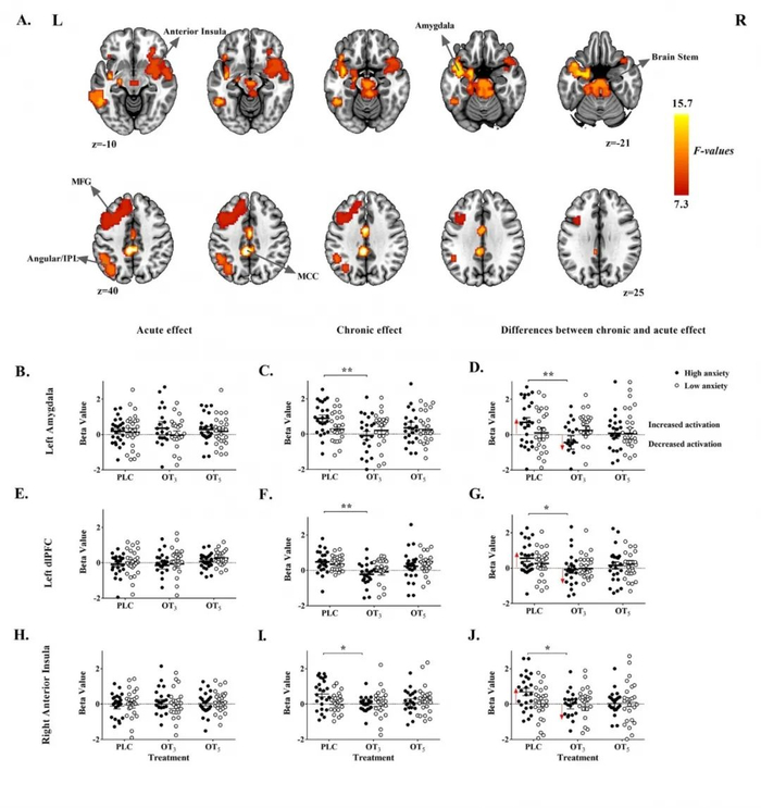 A-J实验脑成像结果图
