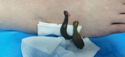 △资料图 图源百色市中医医院