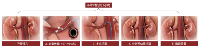 资料来源：美敦力官网，中金公司研究部