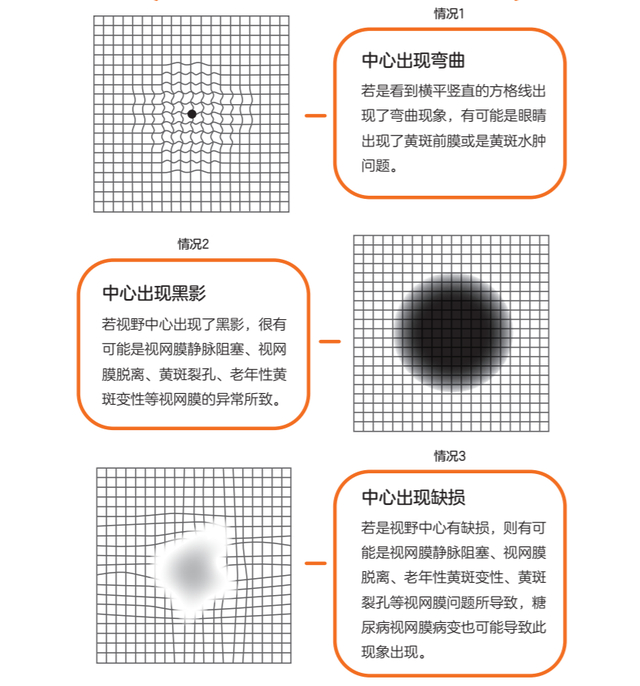 你看见的图像是这样的吗？（《拯救视力 图解指南》内页插图）