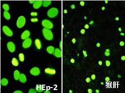 　　显微镜下的荧光模型：ANA核均质型