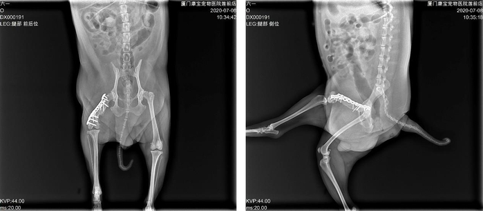 　　术后10个月正位、侧位片