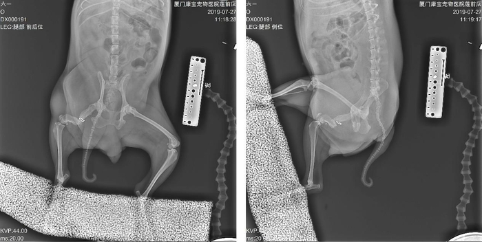 　　术前正位、侧位片