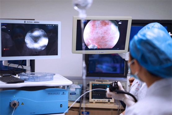 　　▲精微视达倍晰®共聚焦显微影像仪临床应用