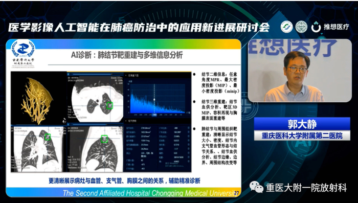 　　重庆医科大学附属第二医院放射科主任郭大静教授