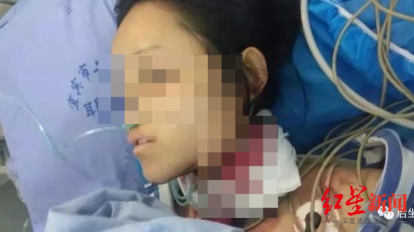 ↑方某婷在医院接受抢救 图据网络