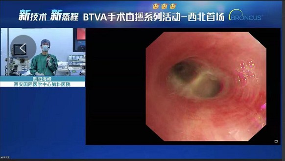 图：BTVA手术后即刻支气管镜下影像