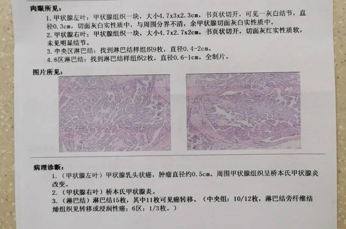 图 | 王波的诊断报告