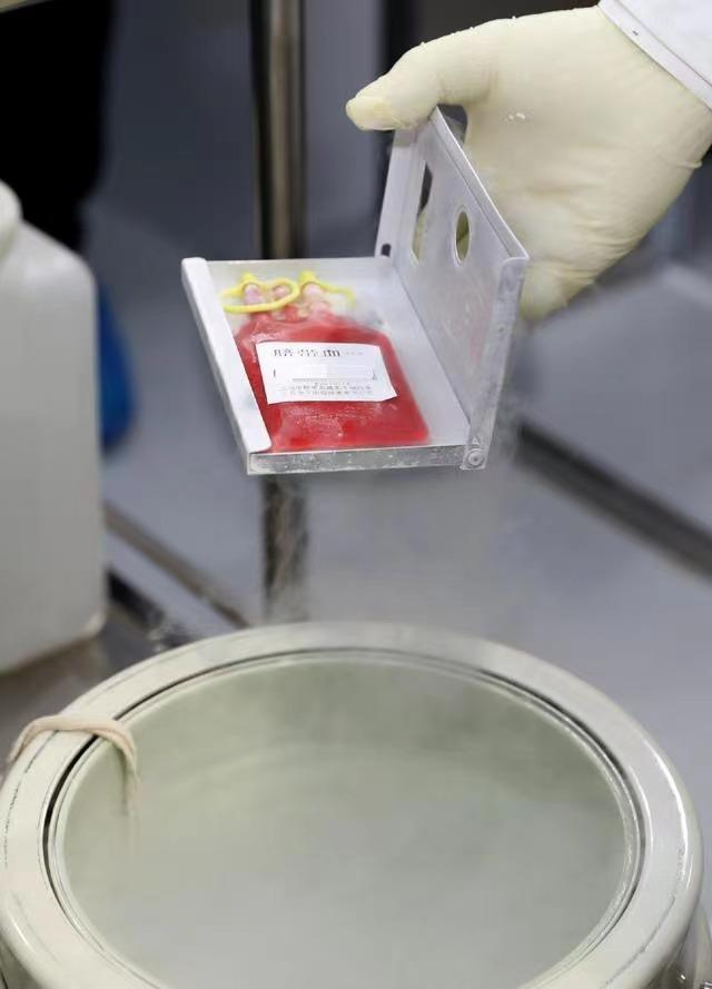 ▲即将进行干细胞复苏操作的脐带血包。资料图。图/新华社