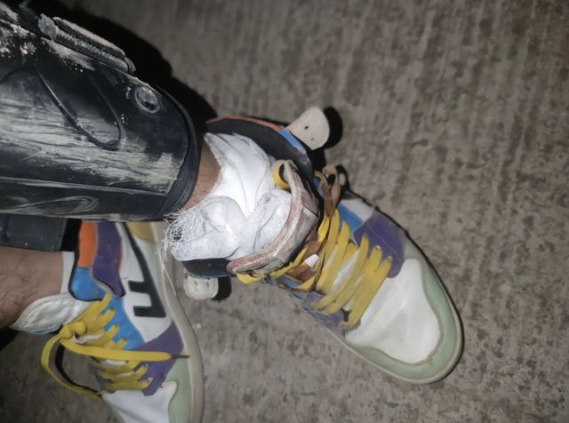 受伤的脚 视频截图