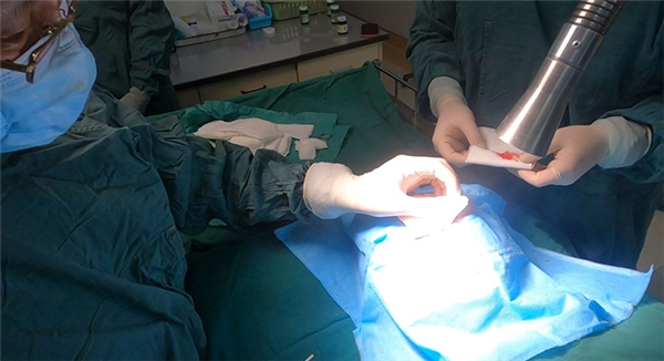 　　中国医科大学附属第一医院皮肤科手术