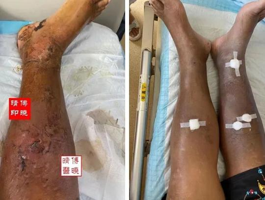 图注：治疗前后对比