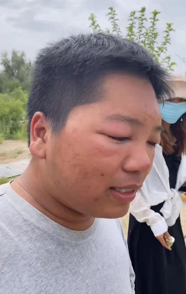 和蜜蜂打交道的过程中，刘元杰少不了被蛰。受访者供图