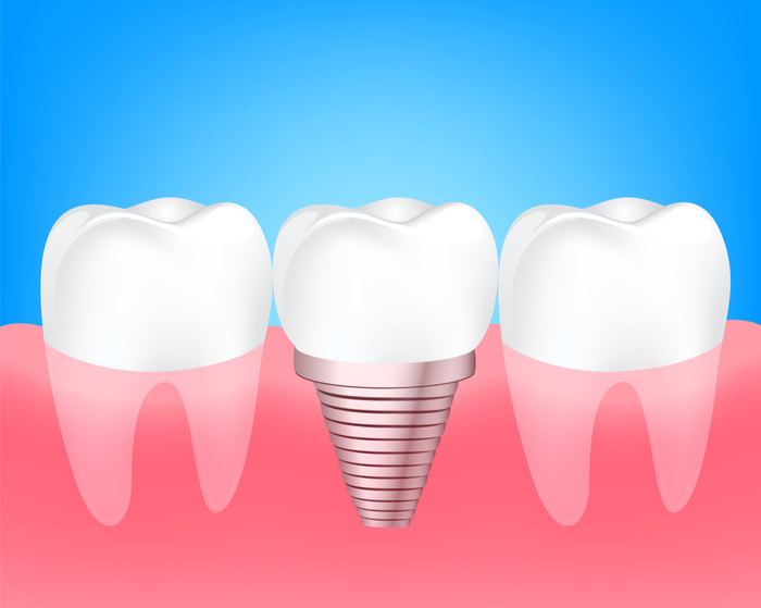 图片来源：图虫网