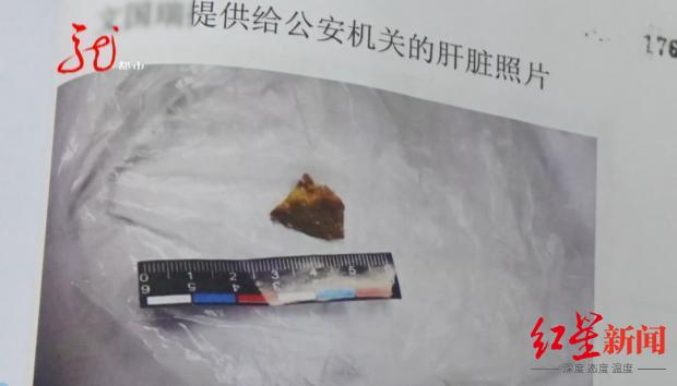 ↑带毒的鸡肝碎片 图据黑龙江广播电视台