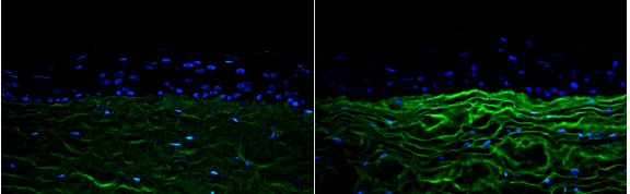　　对比实验:INFIHA-YOUTH,可以增加真皮层45.1%的胶原蛋白I含量