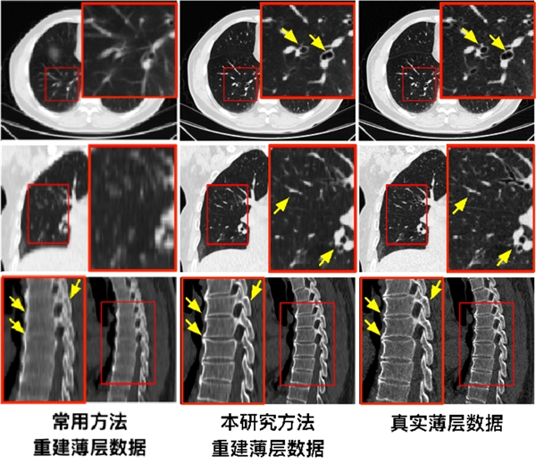 　　重建薄层数据视觉效果比较