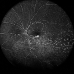 　　102°超广角成像
