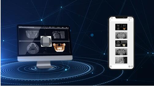 　　四、智能剂量拍摄